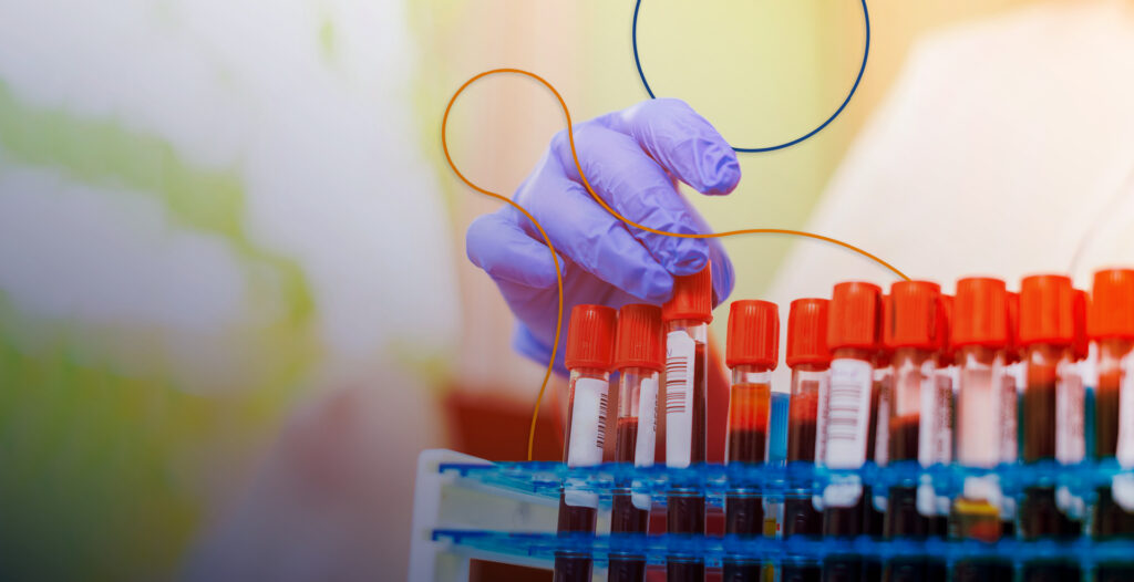 psicologiasdobrasil.com.br - Médico alerta: exame de sangue simples prevê infarto em qualquer pessoa — e quase ninguém sabe disso